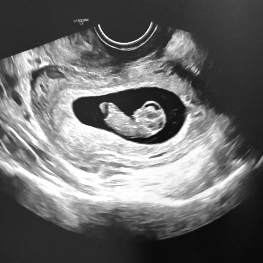 Photo shared by Kristin for their Babylist baby registry.