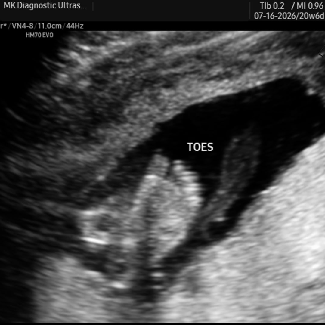 Photo shared by Katie for their Babylist baby registry.