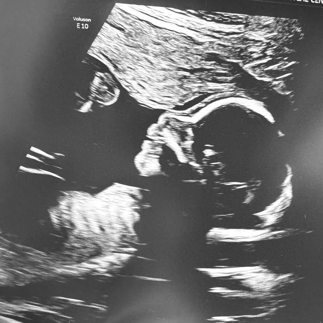 Photo shared by Carol for their Babylist baby registry.