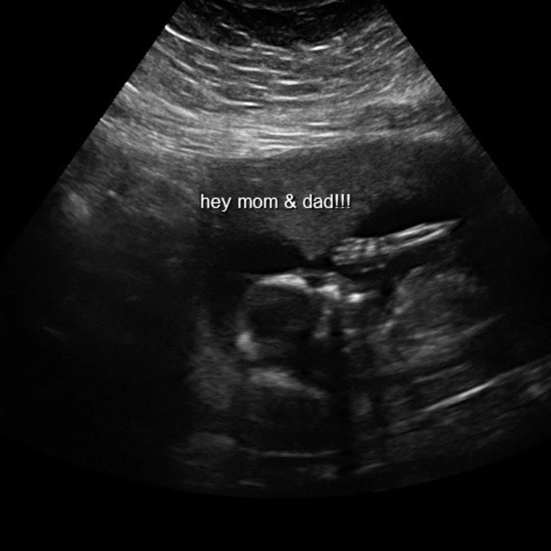 Photo shared by Hannah for their Babylist baby registry.