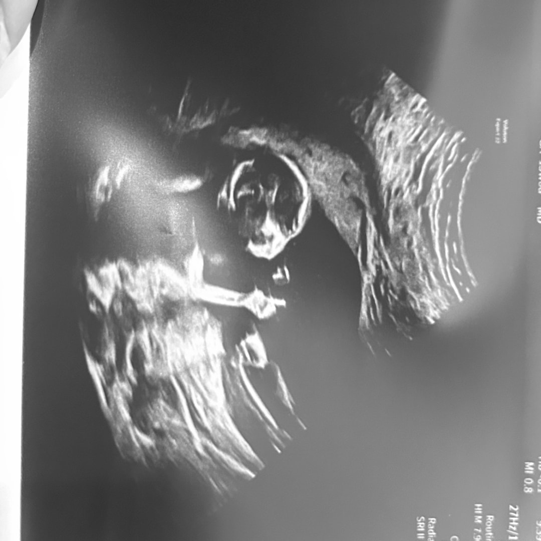 Photo shared by Esmy for their Babylist baby registry.