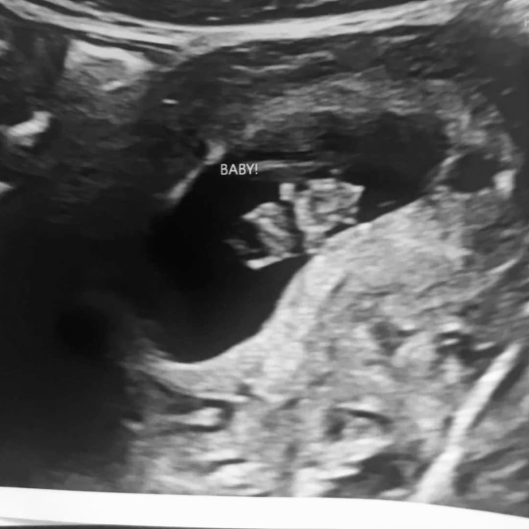 Photo shared by Faith for their Babylist baby registry.