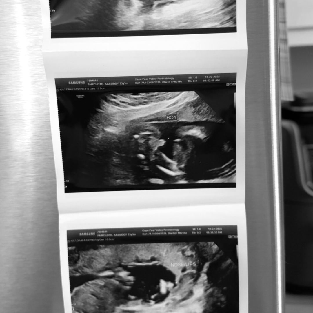 Photo shared by Kassiddy for their Babylist baby registry.