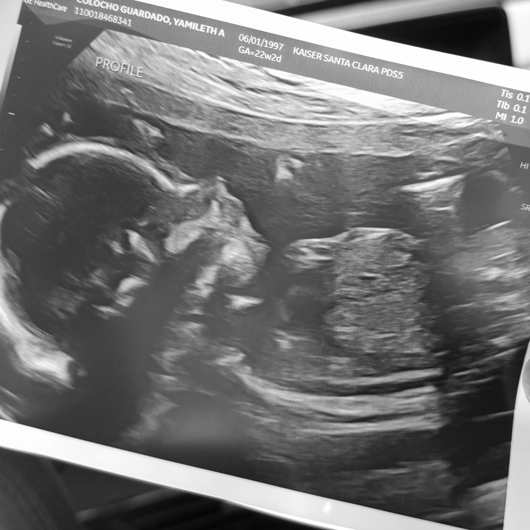 Photo shared by Yami for their Babylist baby registry.