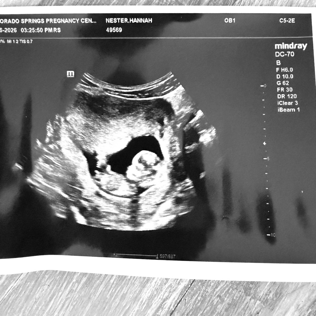 Photo shared by Aksil for their Babylist baby registry.