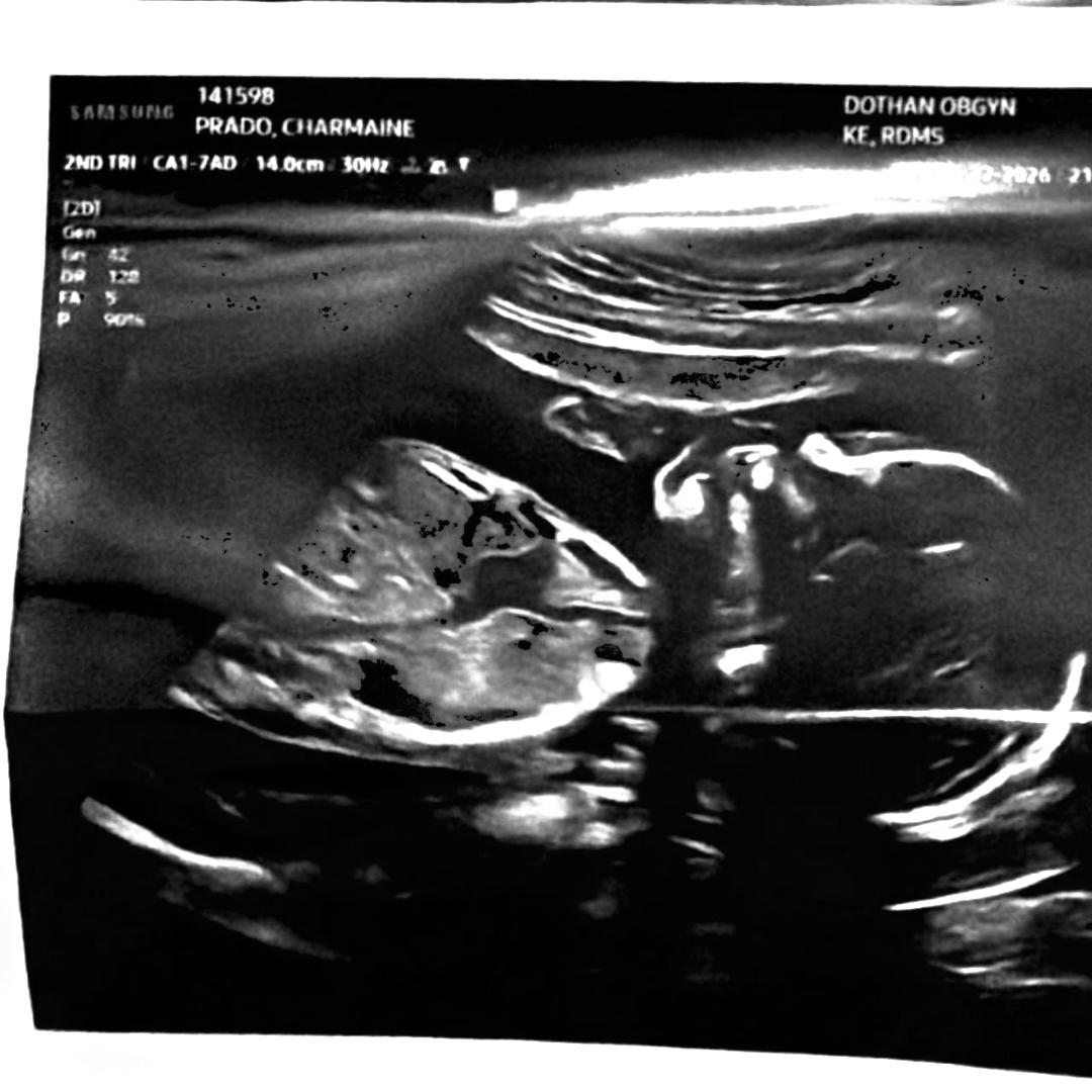 Photo shared by Charmaine for their Babylist baby registry.