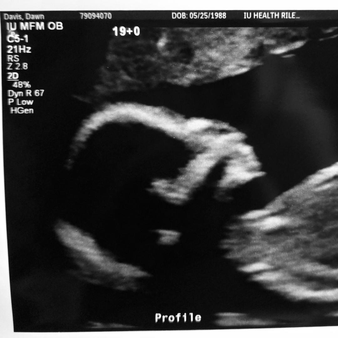 Photo shared by Dawn for their Babylist baby registry.
