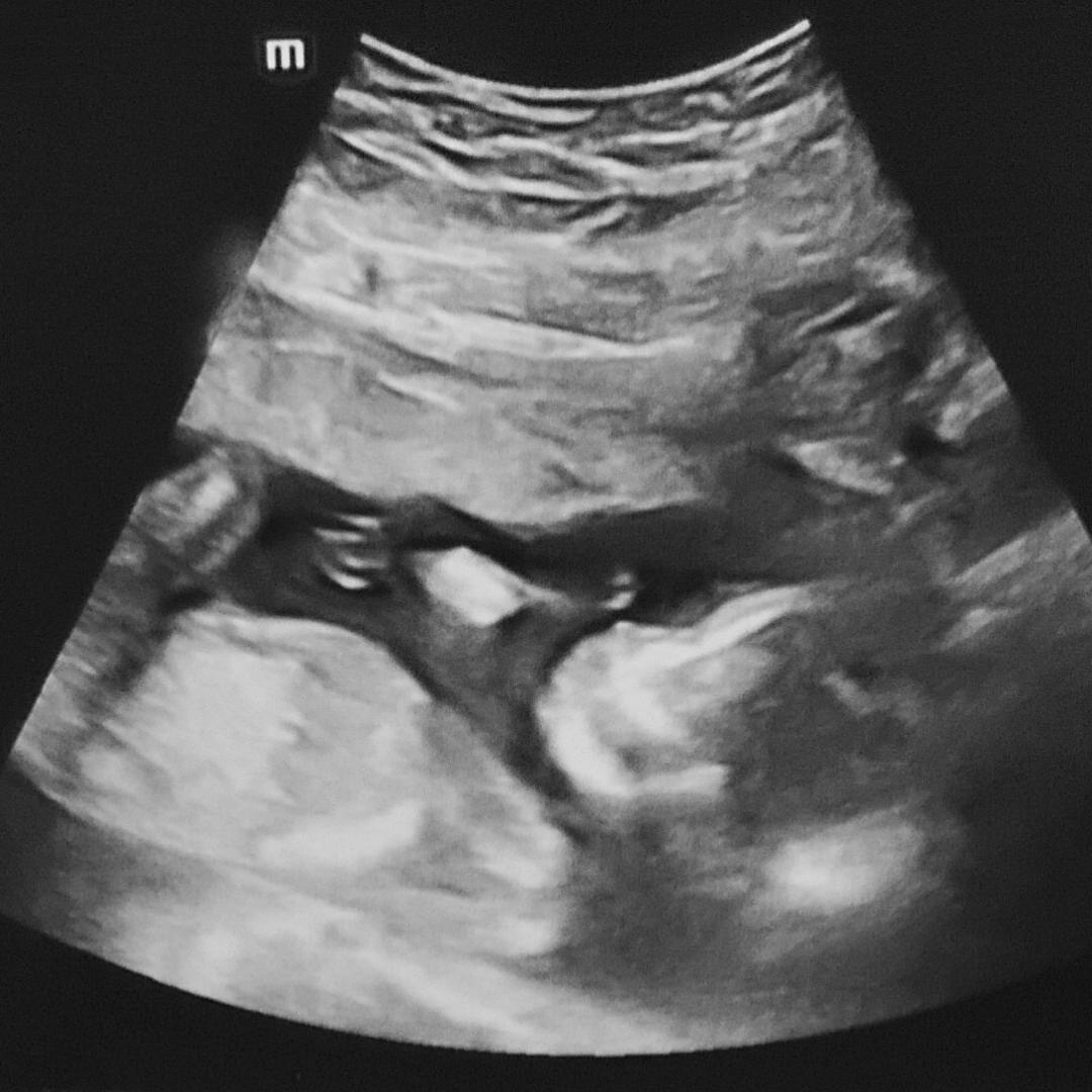 Photo shared by Brynn for their Babylist baby registry.