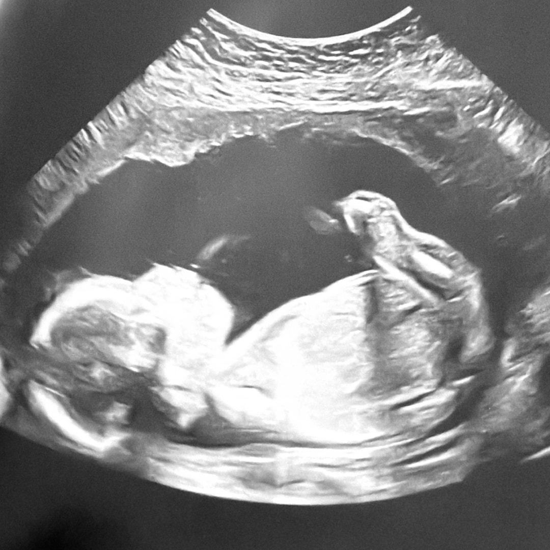 Photo shared by Anna for their Babylist baby registry.