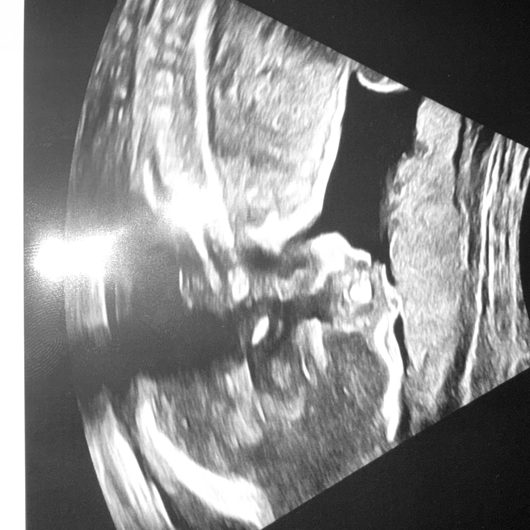 Photo shared by Kiara for their Babylist baby registry.