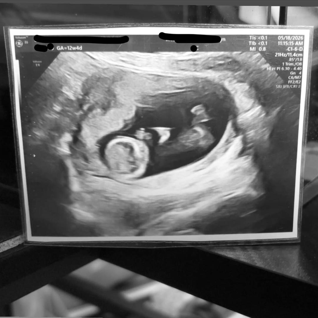 Photo shared by Hannah for their Babylist baby registry.