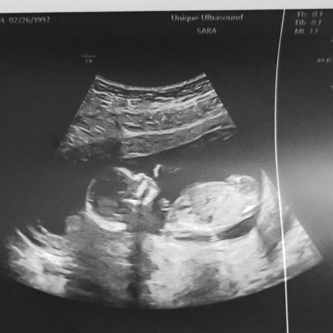 Photo shared by Sarah for their Babylist baby registry.