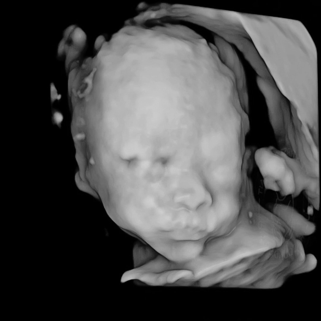 Photo shared by Brenda for their Babylist baby registry.