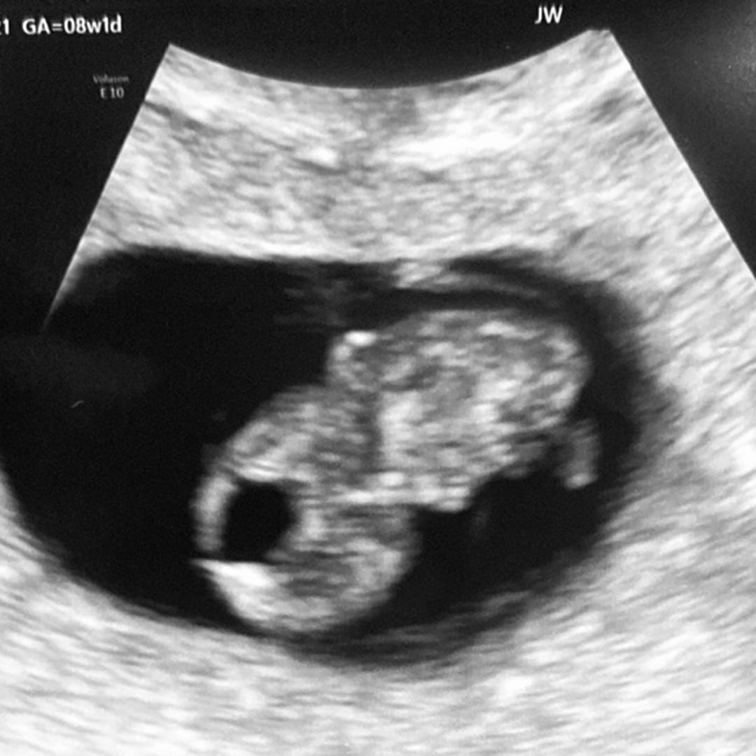 Photo shared by Jasmyn for their Babylist baby registry.