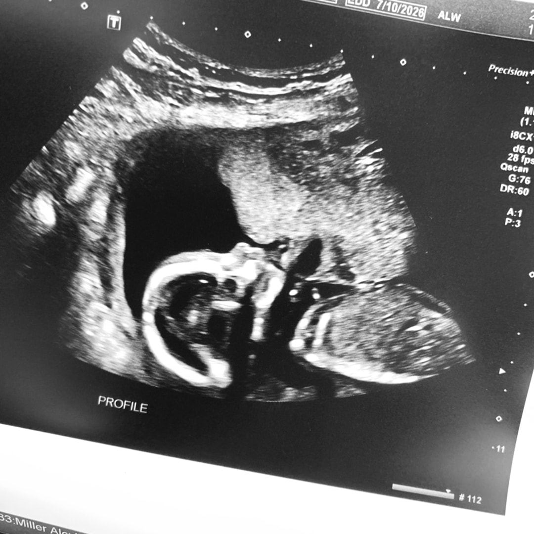 Photo shared by Alexis for their Babylist baby registry.