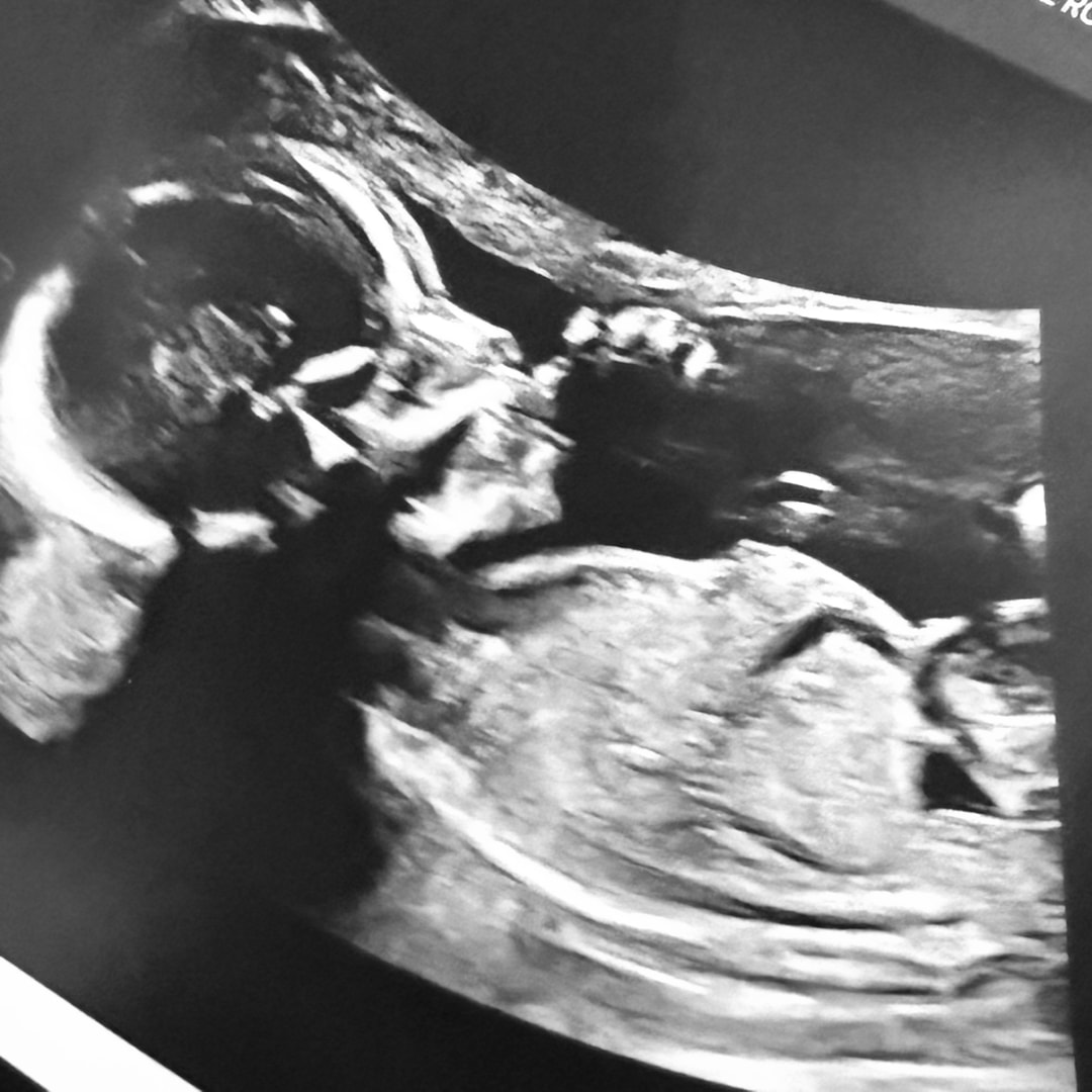 Photo shared by Taylor for their Babylist baby registry.