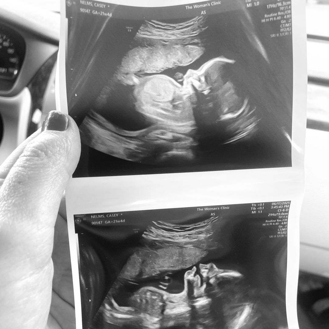 Photo shared by Casey for their Babylist baby registry.