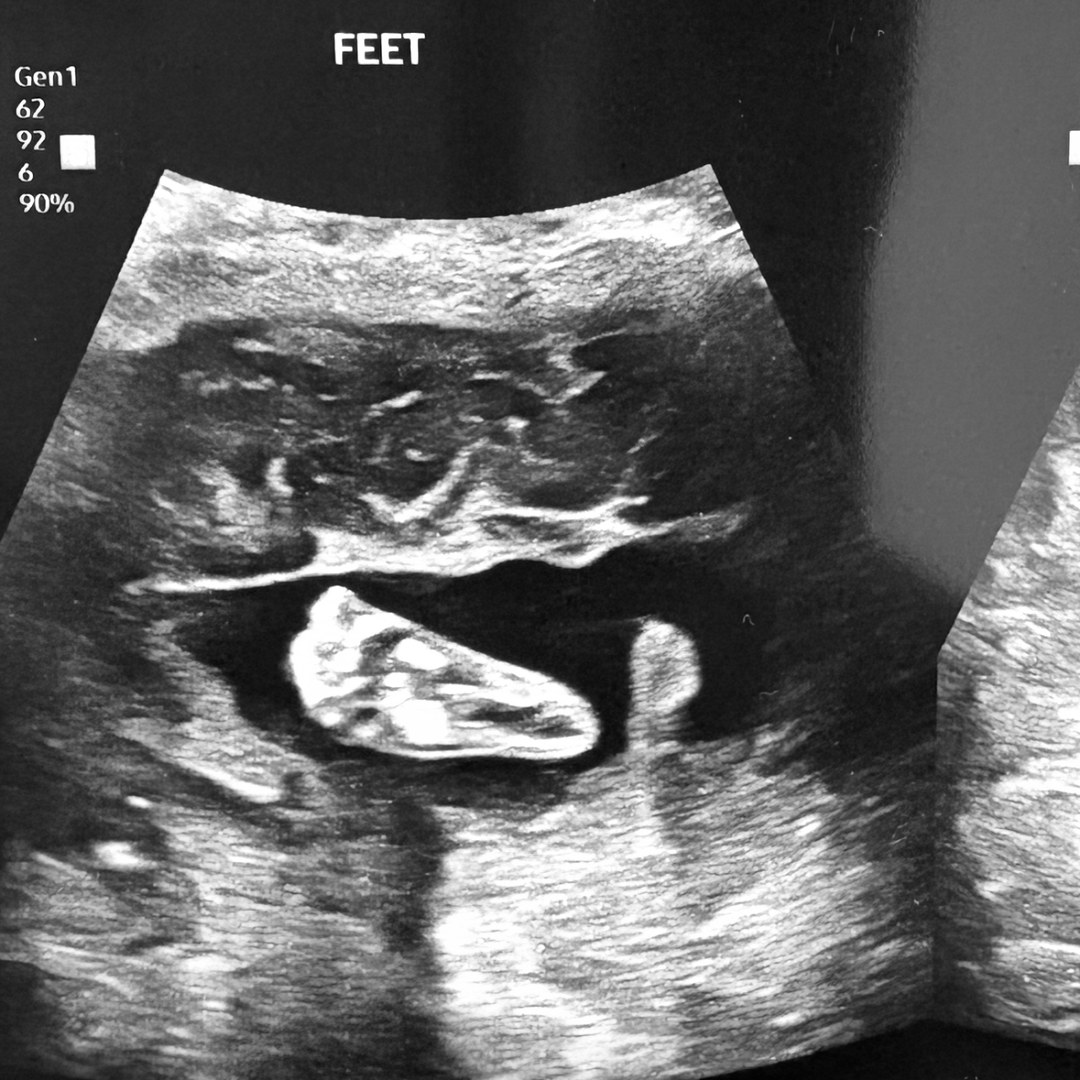 Photo shared by Jenna for their Babylist baby registry.