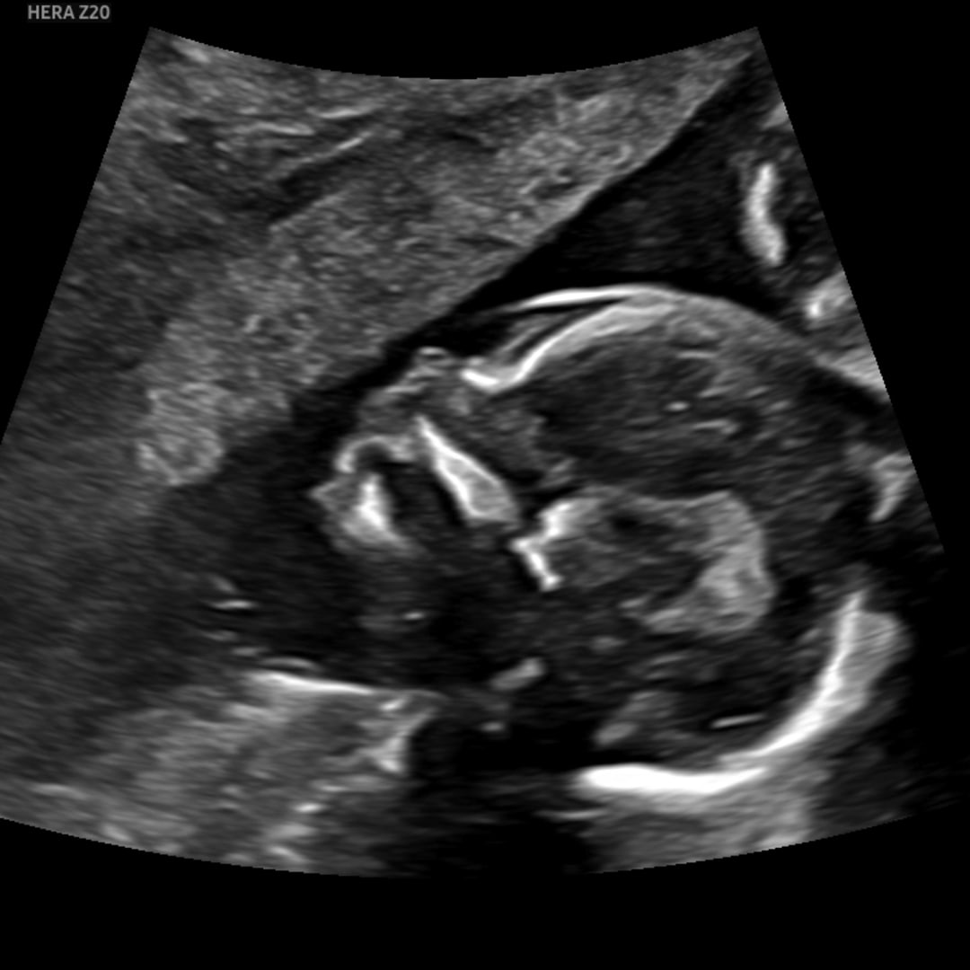 Photo shared by Julianne for their Babylist baby registry.