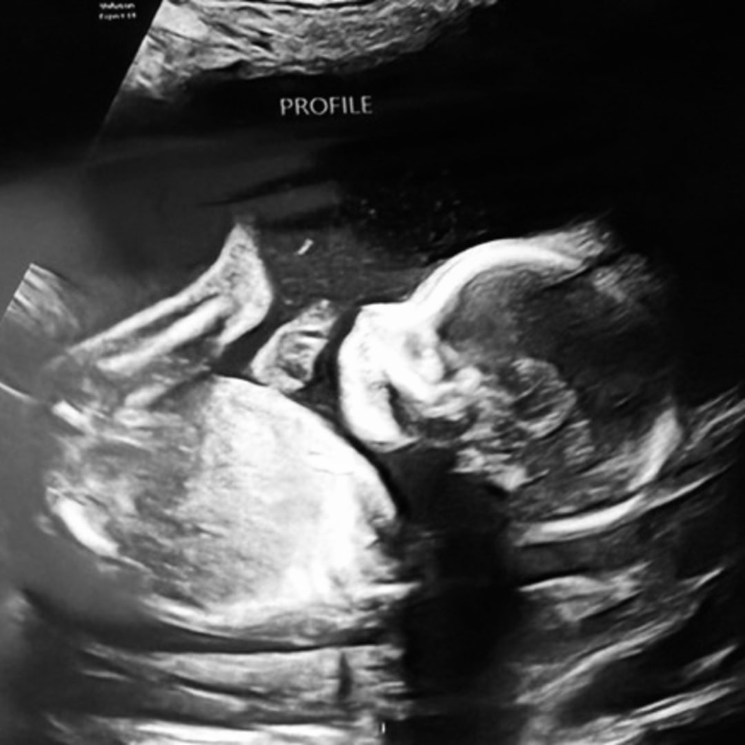 Photo shared by Kristen for their Babylist baby registry.