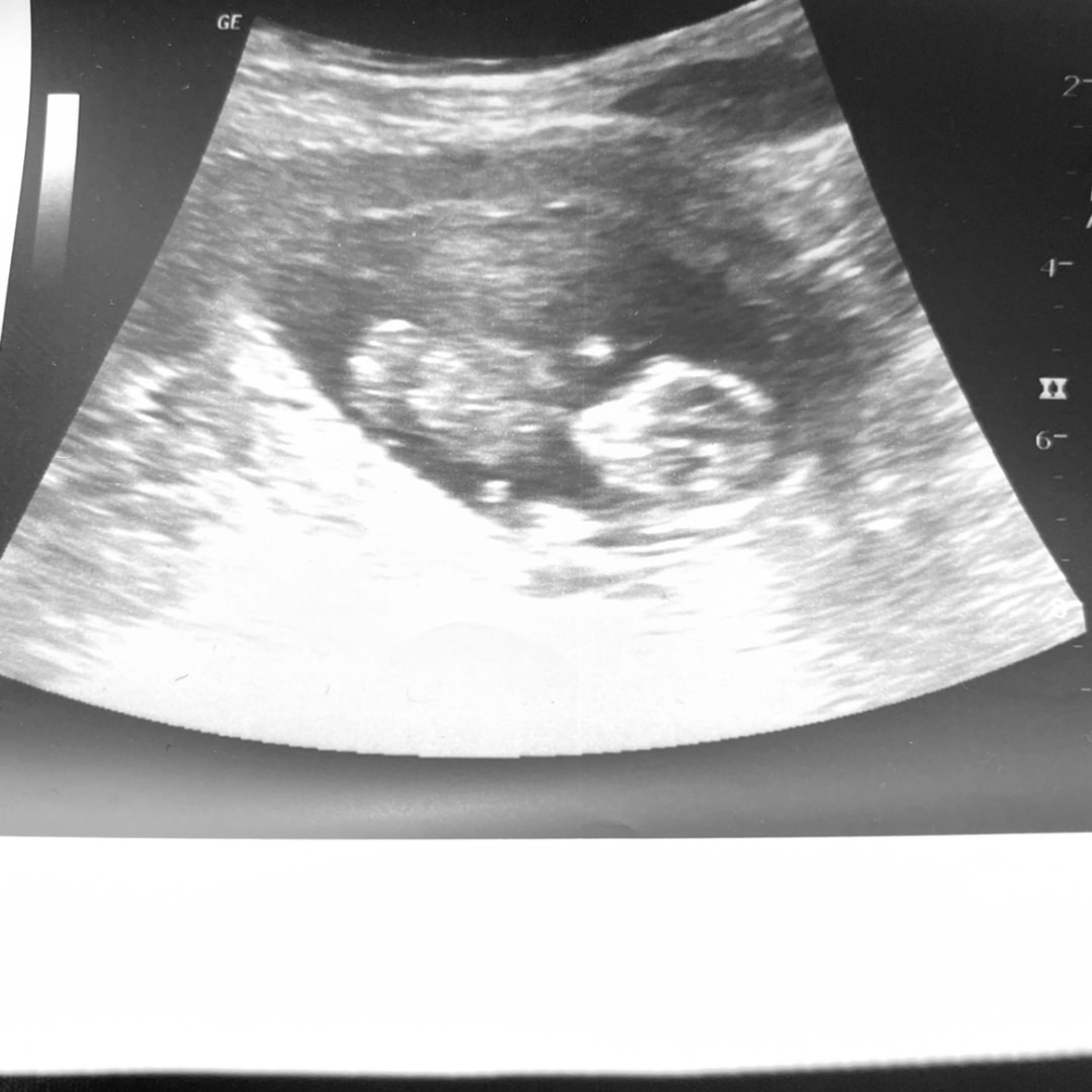 Photo shared by Haylene for their Babylist baby registry.