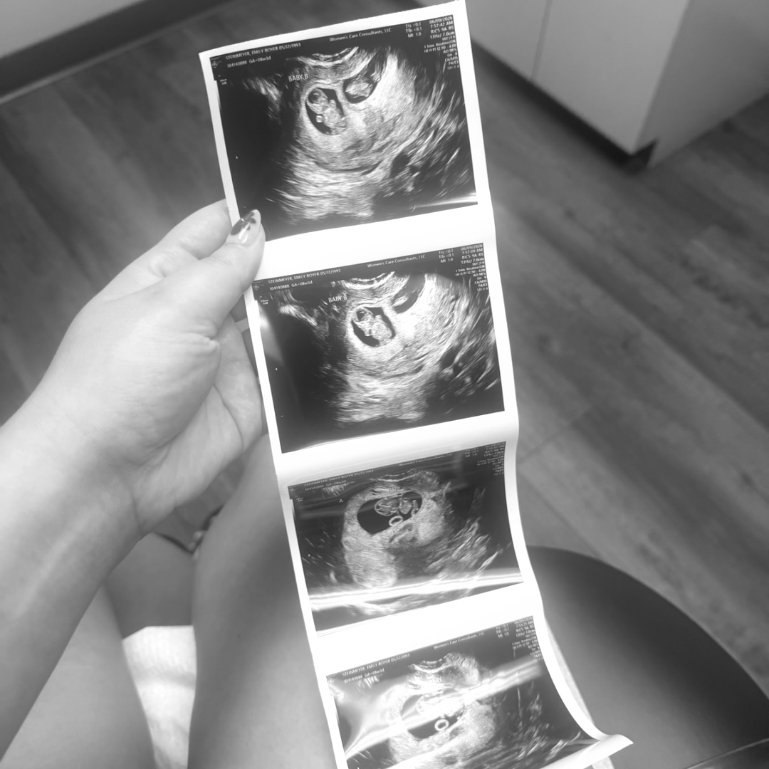 Photo shared by Emily for their Babylist baby registry.