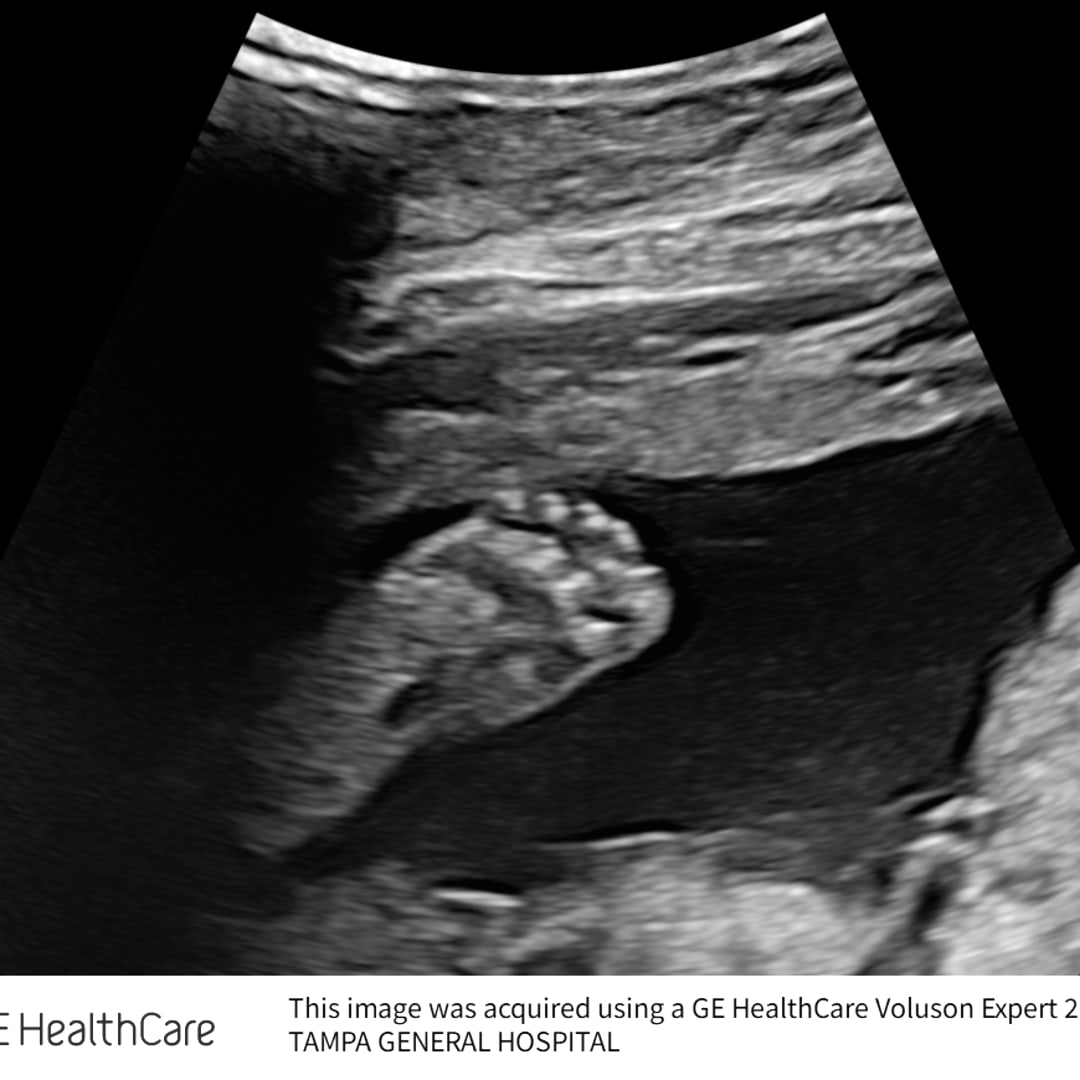 Photo shared by Amelia for their Babylist baby registry.