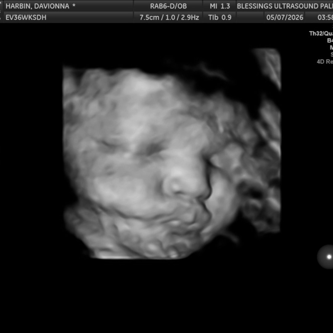 Photo shared by Davionna for their Babylist baby registry.