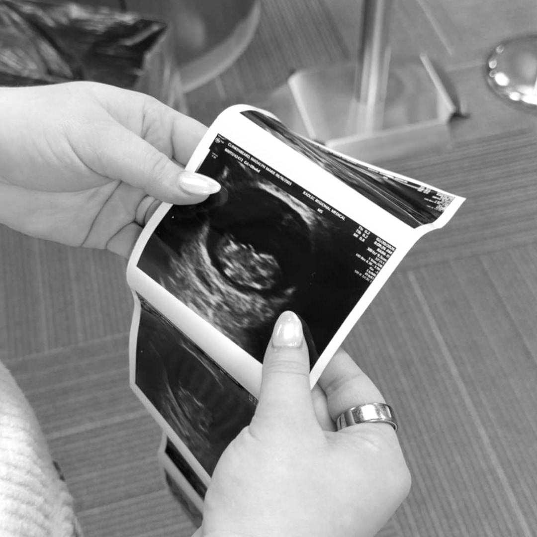 Photo shared by Madalyn for their Babylist baby registry.