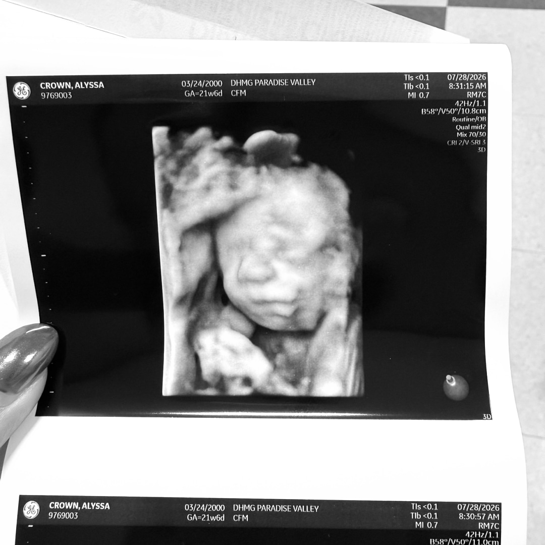 Photo shared by Alyssa for their Babylist baby registry.