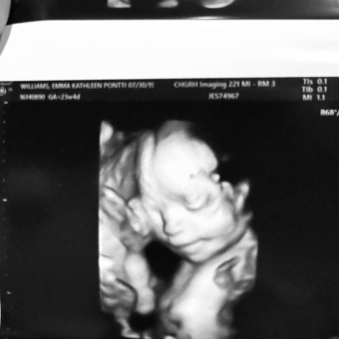 Photo shared by Emma for their Babylist baby registry.