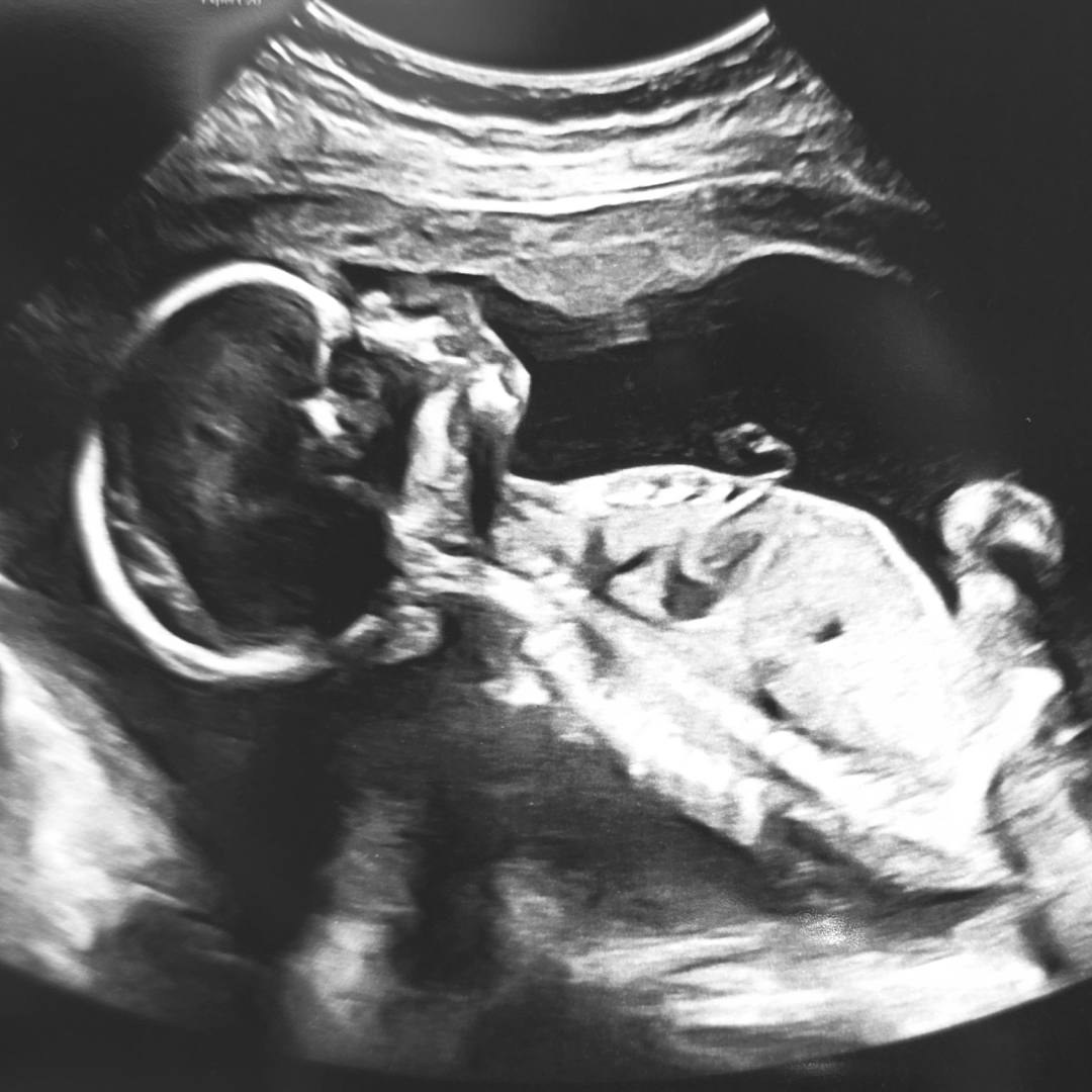 Photo shared by Charis for their Babylist baby registry.