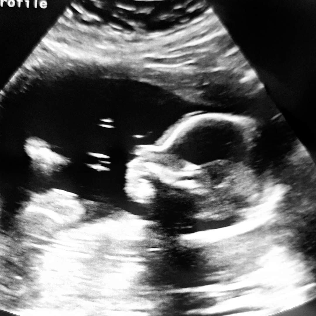 Photo shared by Victoria Morgan for their Babylist baby registry.