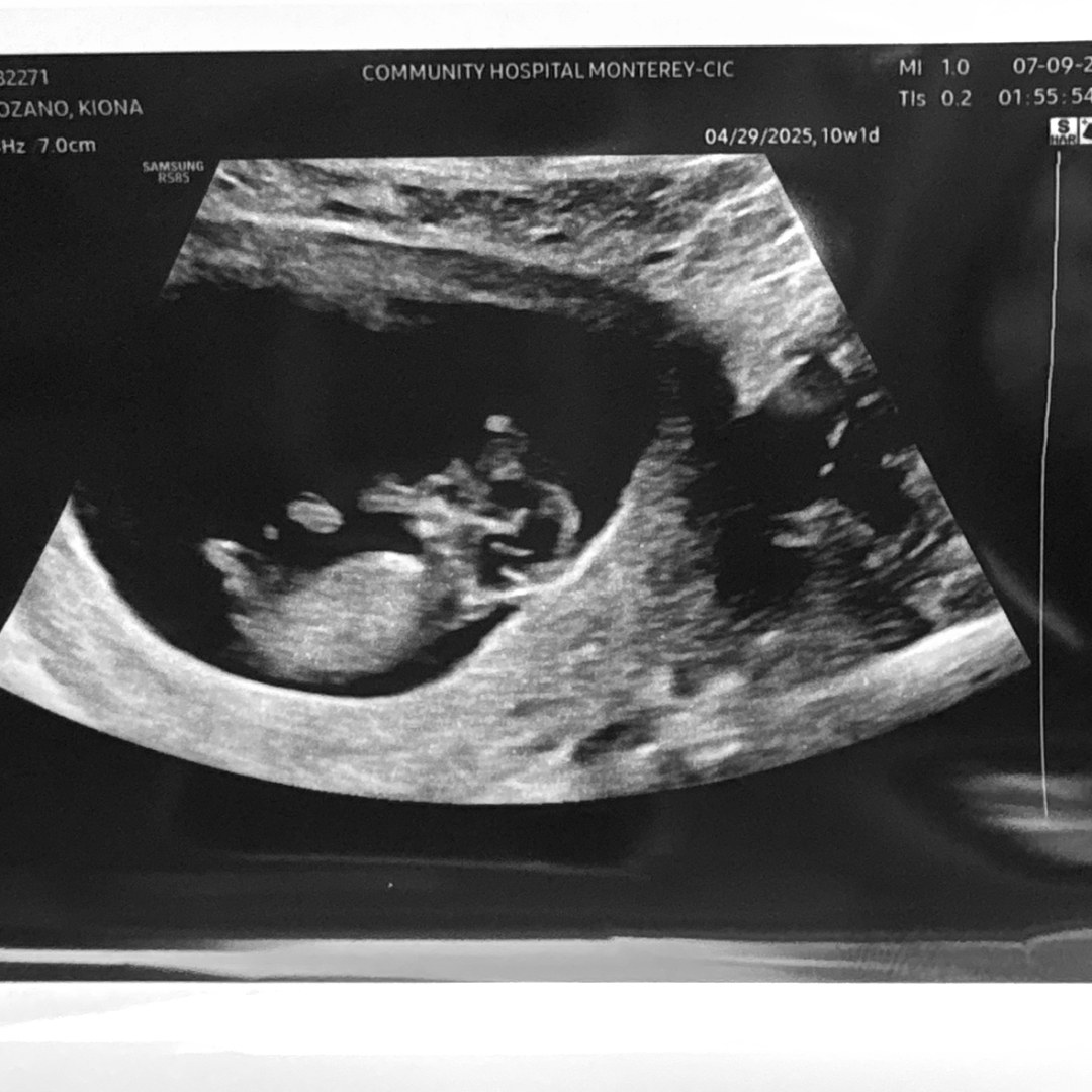 Photo shared by Kiona for their Babylist baby registry.