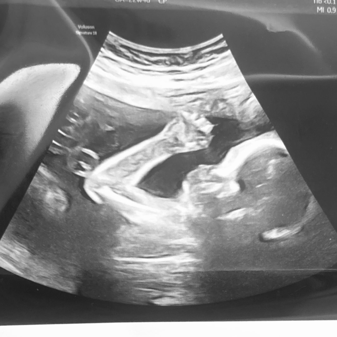 Photo shared by Kennedie for their Babylist baby registry.