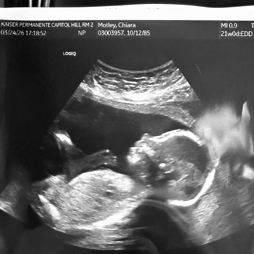 Photo shared by Chiara for their Babylist baby registry.