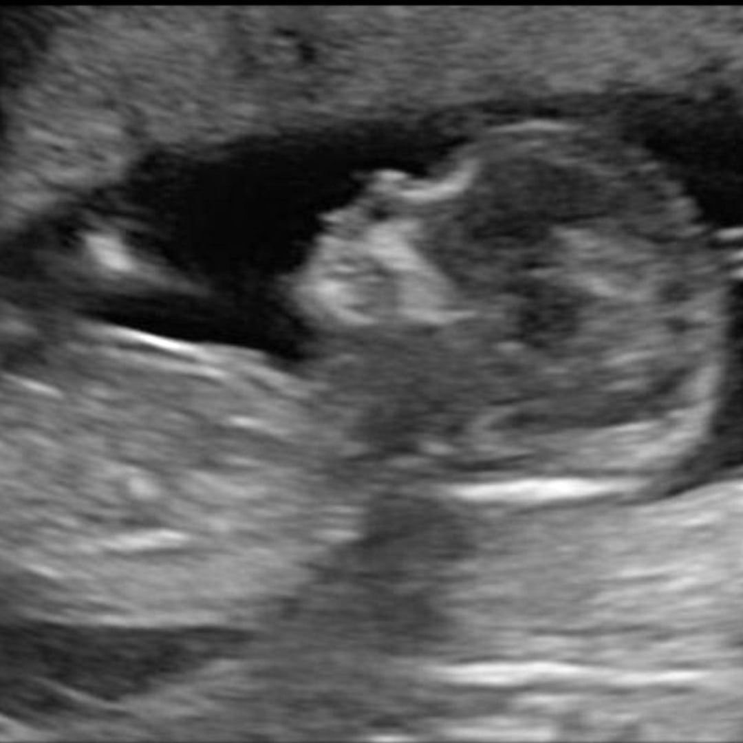 Photo shared by Riley for their Babylist baby registry.