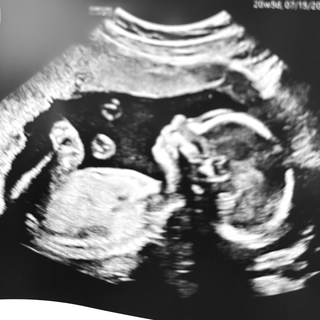 Photo shared by Sydney for their Babylist baby registry.