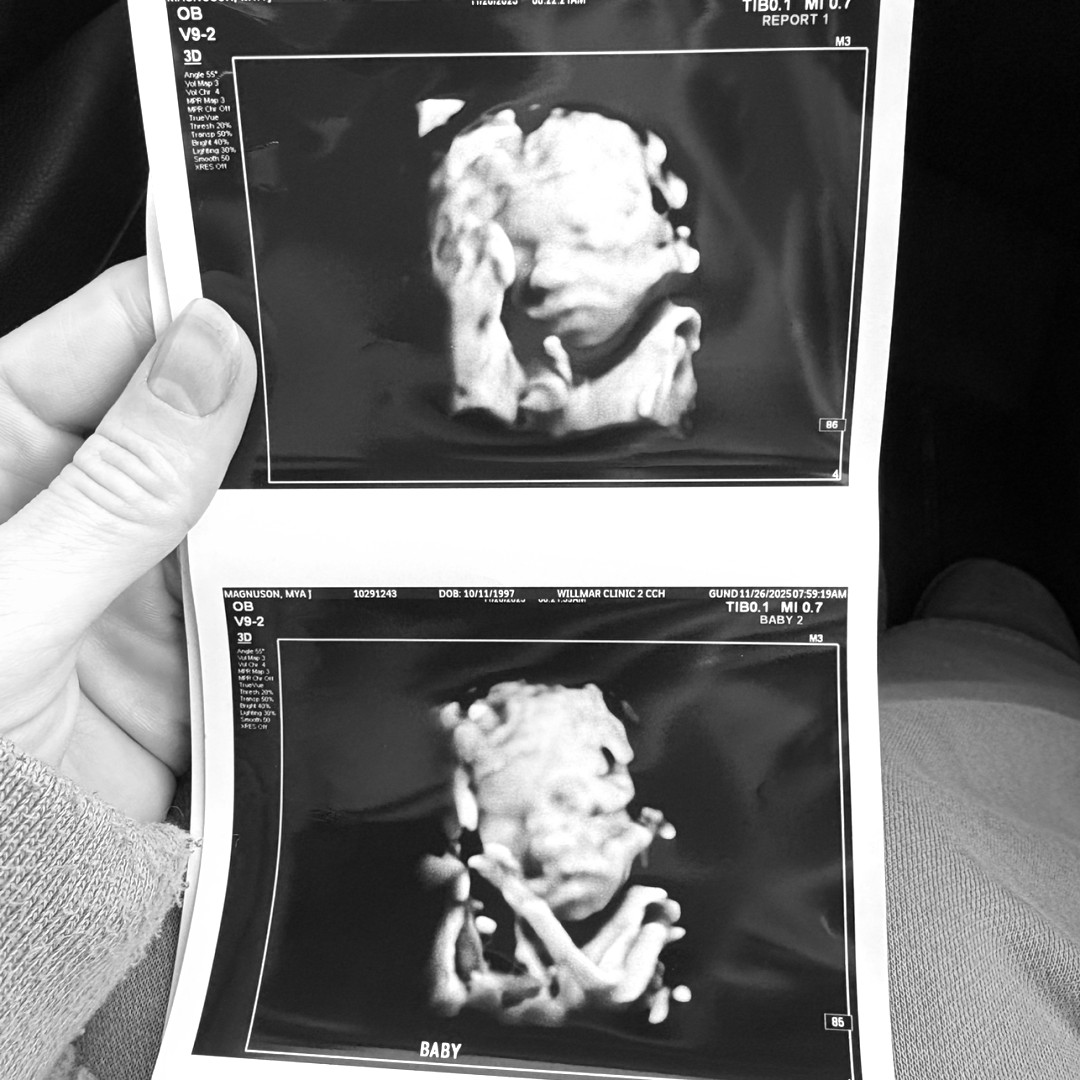 Photo shared by Mya for their Babylist baby registry.