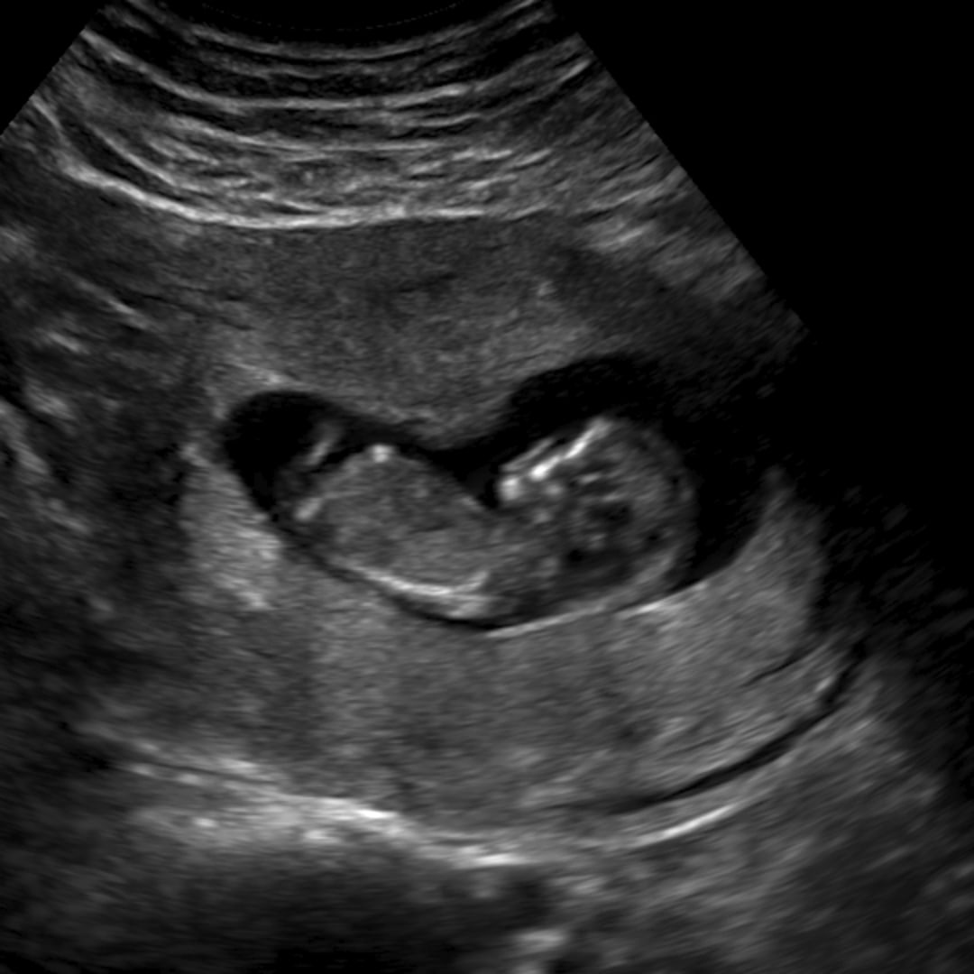 Photo shared by Vivian for their Babylist baby registry.