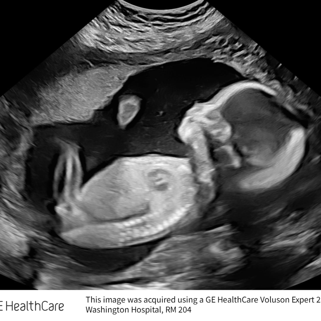 Photo shared by Courtney for their Babylist baby registry.