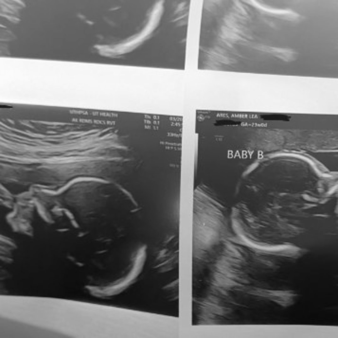 Photo shared by Amber Lea for their Babylist baby registry.