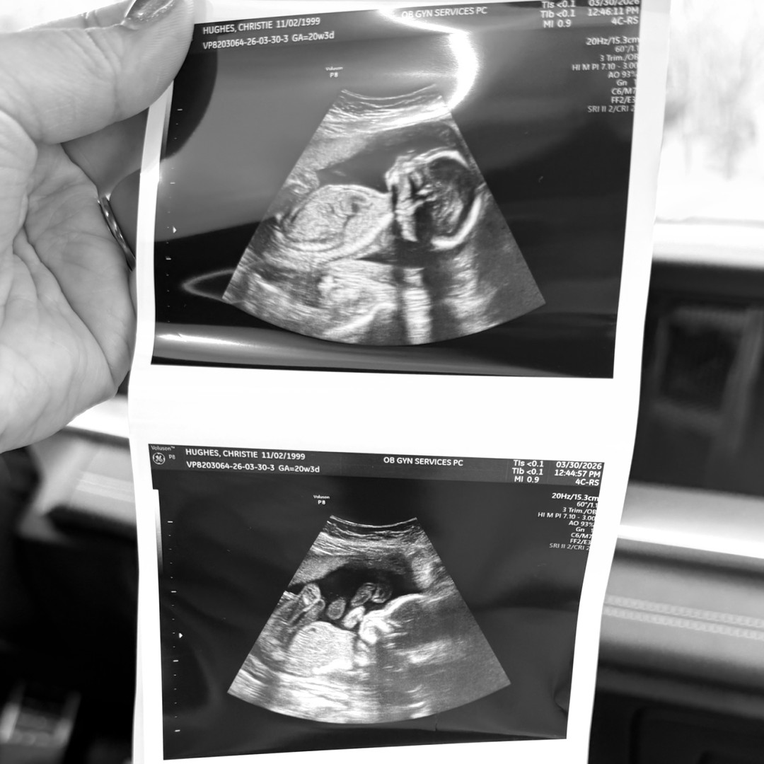 Photo shared by Christie for their Babylist baby registry.