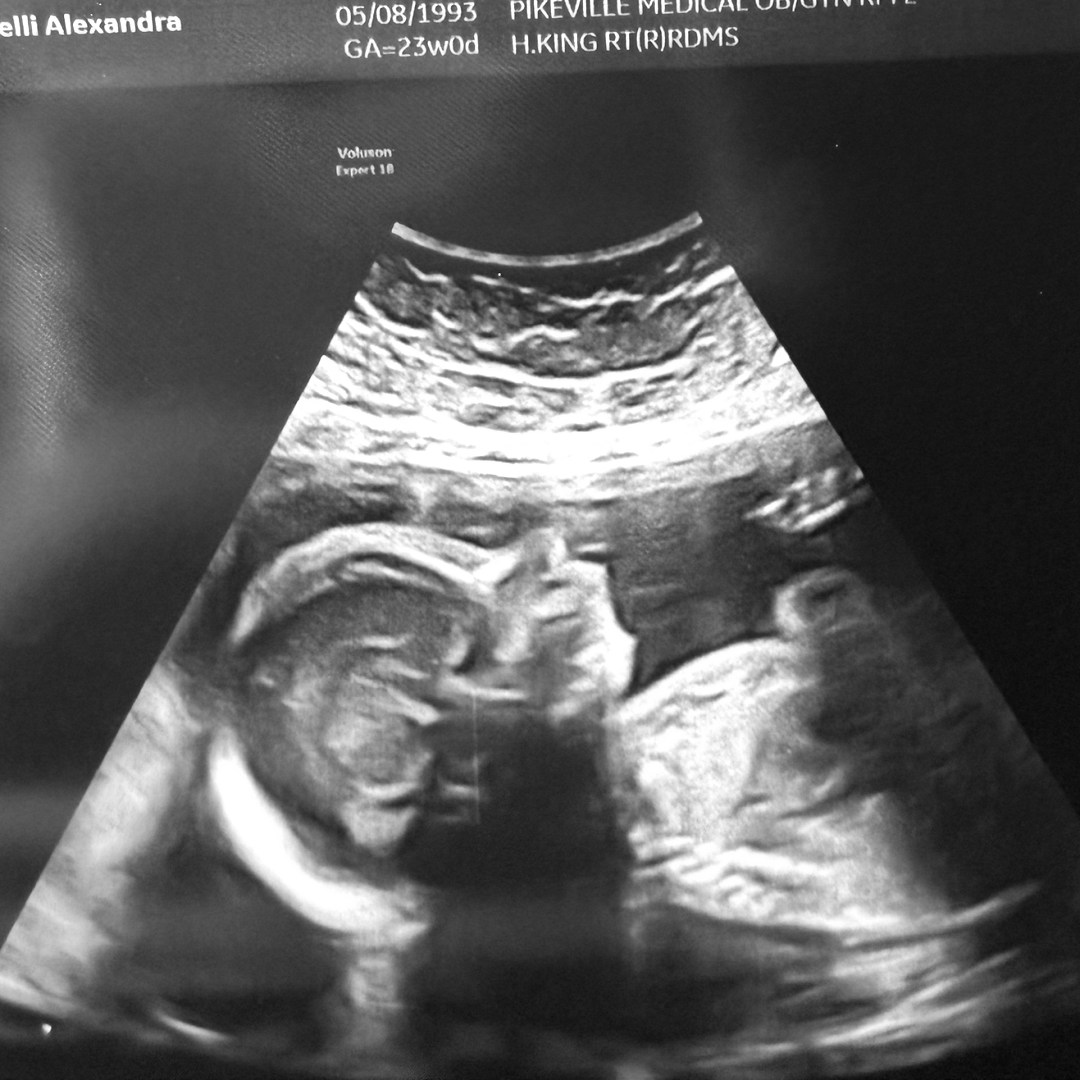 Photo shared by Alex for their Babylist baby registry.