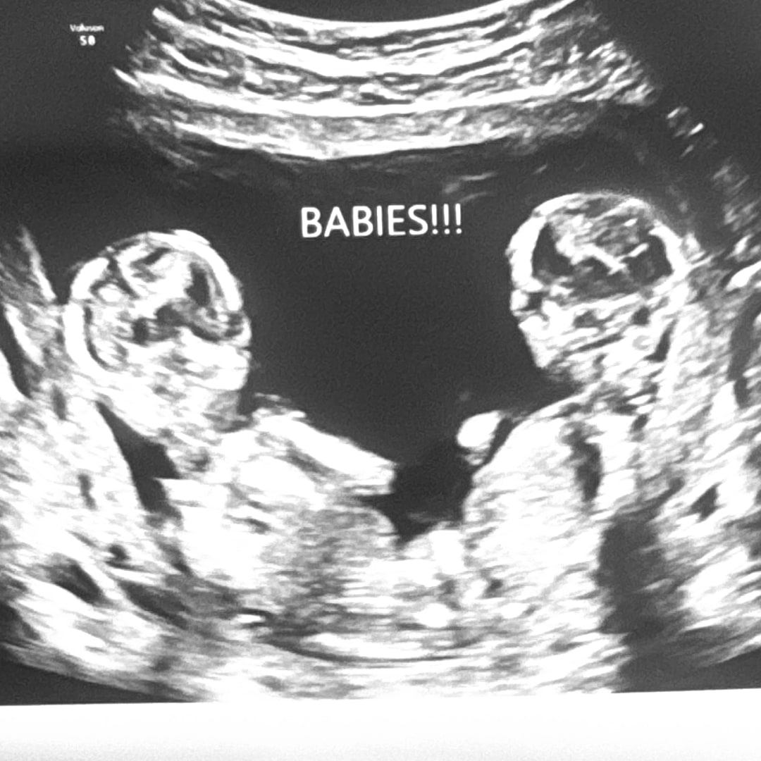 Photo shared by Angeline for their Babylist baby registry.