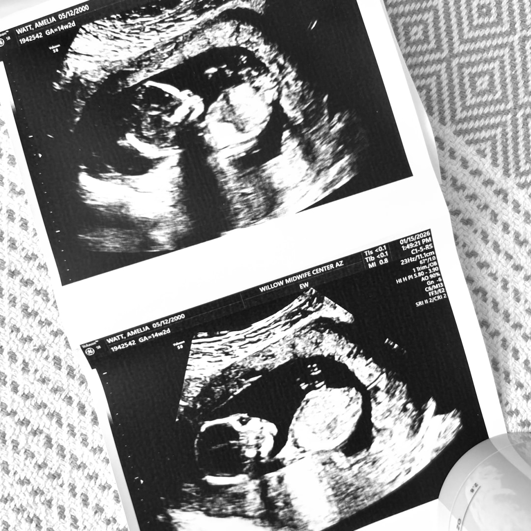 Photo shared by Amelia for their Babylist baby registry.