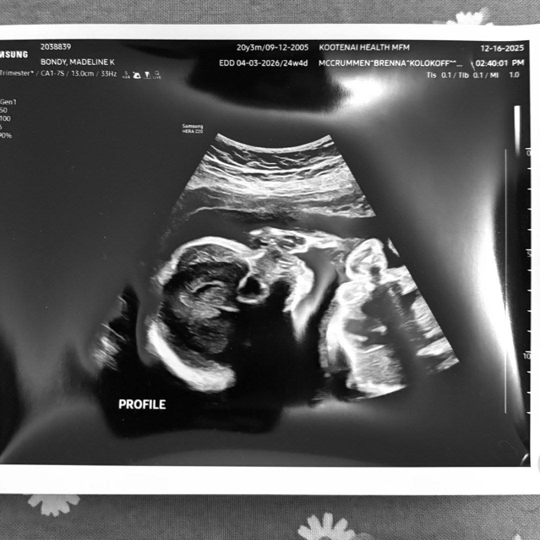 Photo shared by Madeline for their Babylist baby registry.