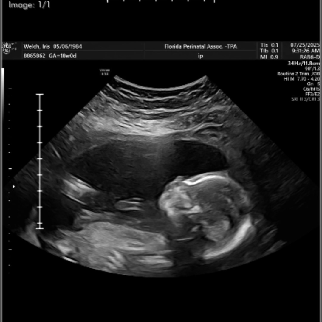 Photo shared by Iris for their Babylist baby registry.