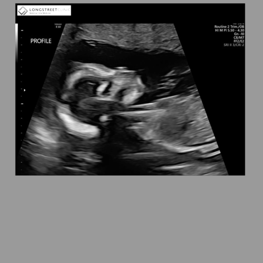 Photo shared by Heidy for their Babylist baby registry.