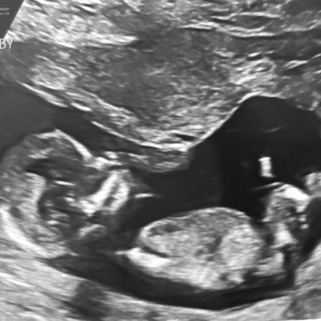 Photo shared by Lauren for their Babylist baby registry.